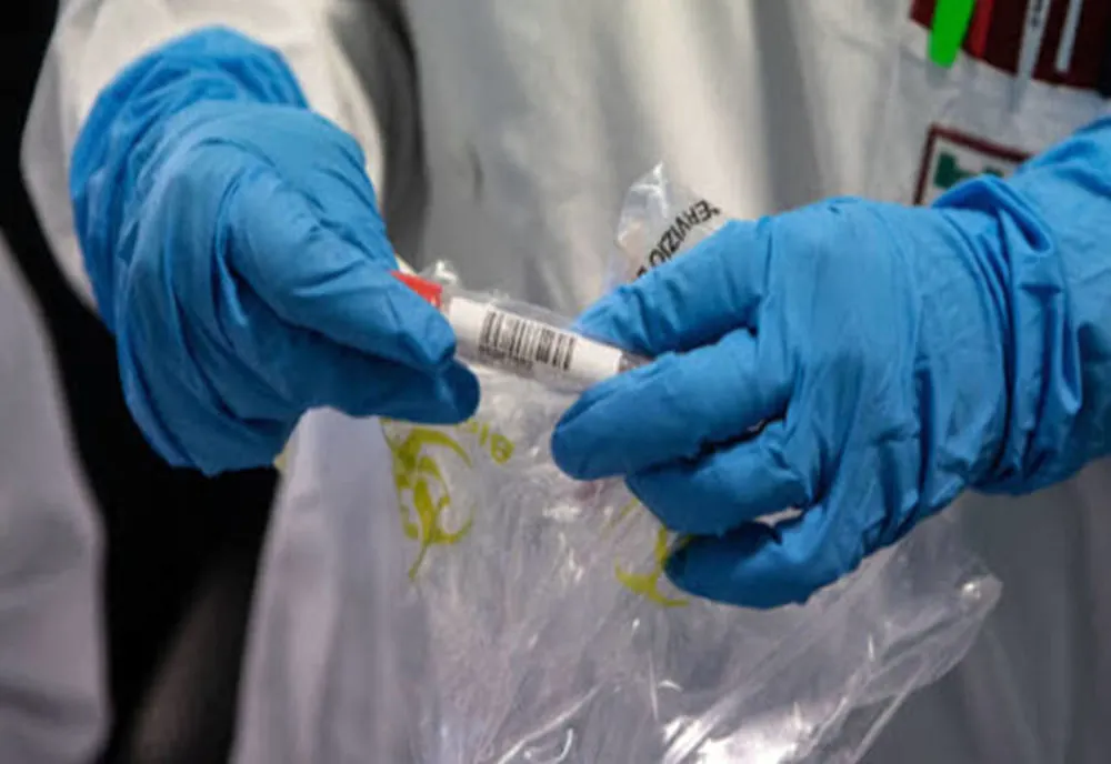 Cărășenii vindecați de coronavirus nu se înghesuie să doneze plasmă