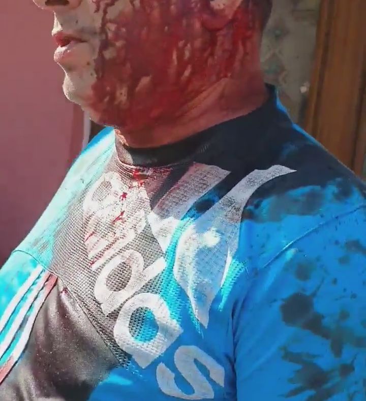 ATENȚIE IMAGINI EXPLICITE! Bătaie cu parul și capete sparte în Dealul Crucii