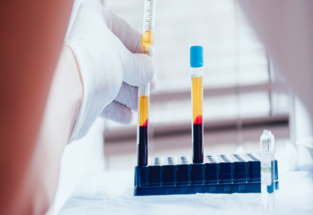 Situație de criză la centrul de transfuzii din Reșița