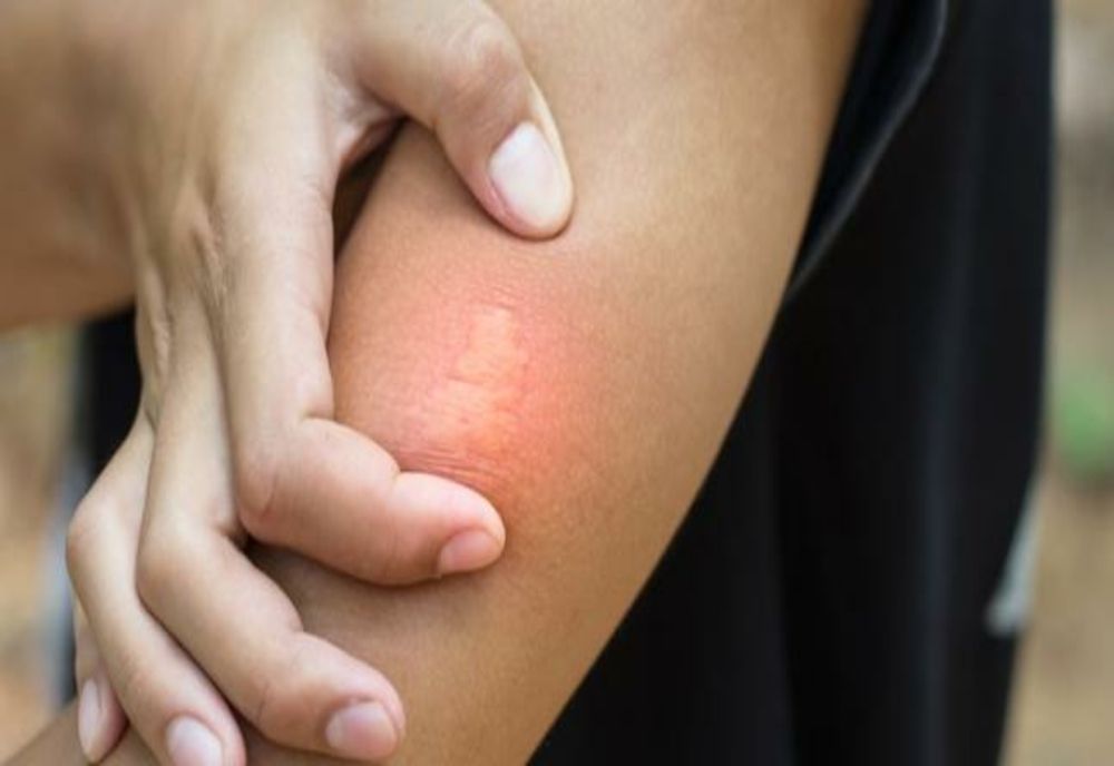 Femeie din Caraș-Severin, în stare critică la spital, după ce a fost mușcată de o viespe