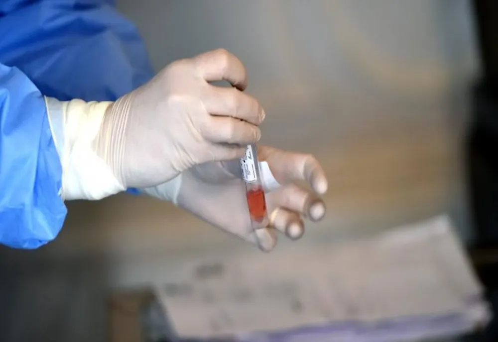 Al cincelea deces cauzat de infecția cu COVID 19