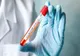 Bărbat internat cu suspiciune de coronavirus